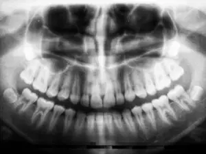 Panorex Imaging